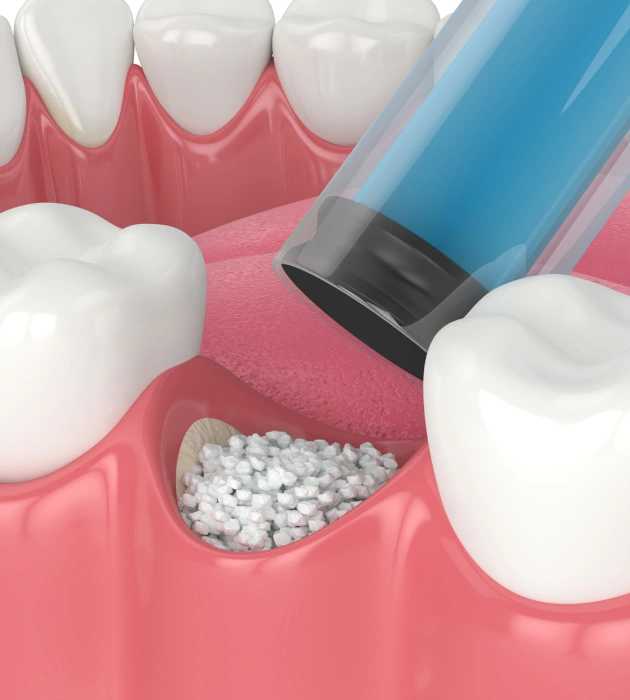 Restoring the Healthy Foundation of Your Smile