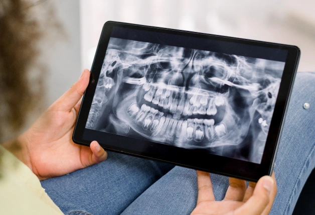 Digital X-Ray