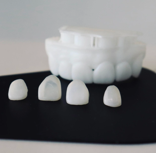 Ultra Thin Porcelain Applied With Minimal Tooth Reduction