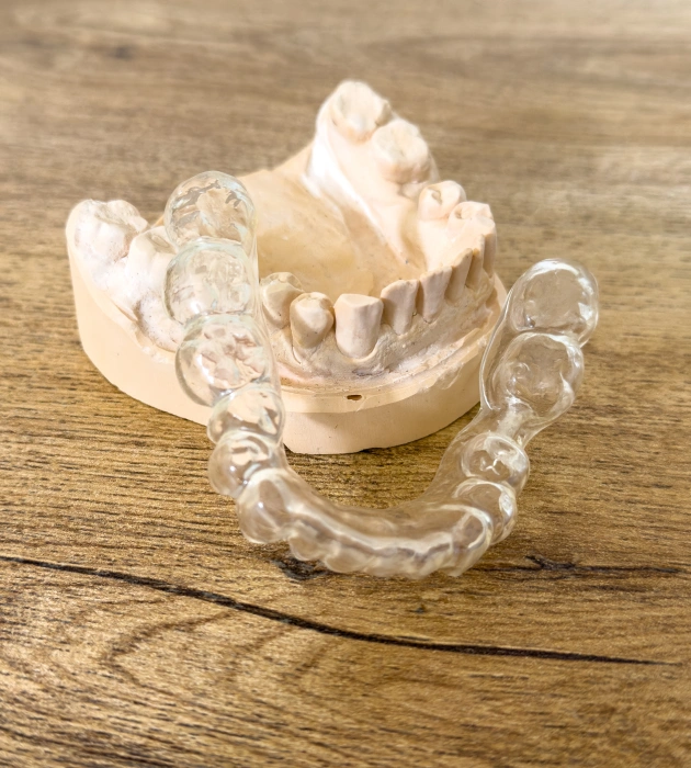 Correcting How Your Teeth Come Together